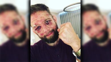 Nik Lentz Retires After UFC 257: “I Lost About 40% Of My Vision”