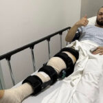 Flip Gordon Undergoes Surgery For Ruptured Patella Tendon