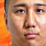 GLEAT’s Go Miyake Sidelined With Jaw Fracture