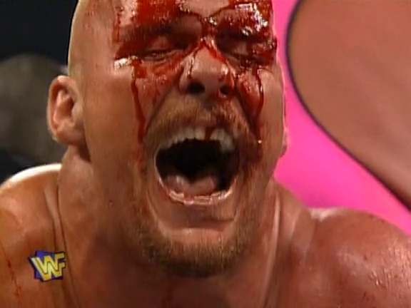 steve austin